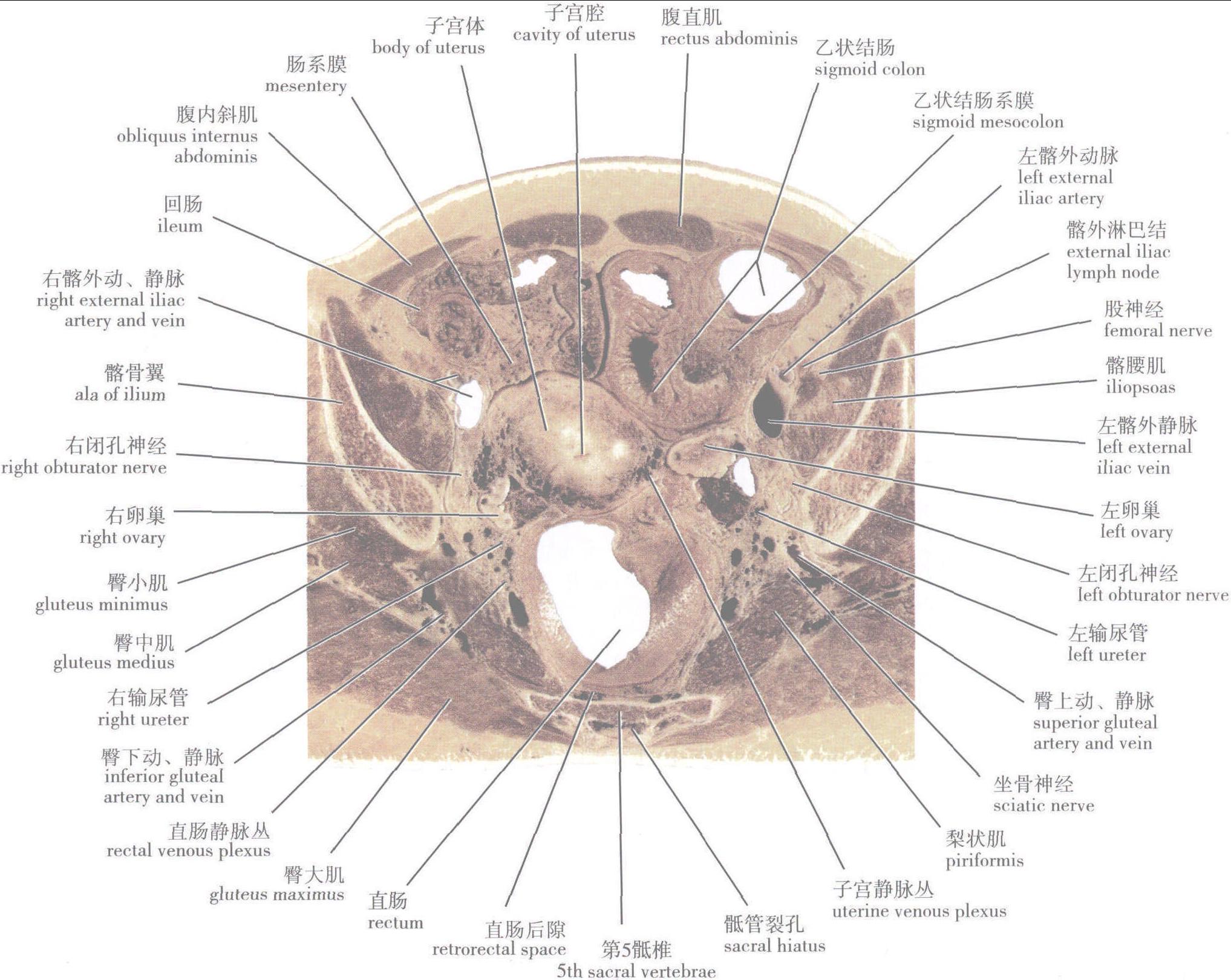 第四節(jié) 女性盆部連續(xù)橫斷層面